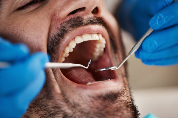 Best Dentist for Tooth Abscess  in Silver Lake, FL